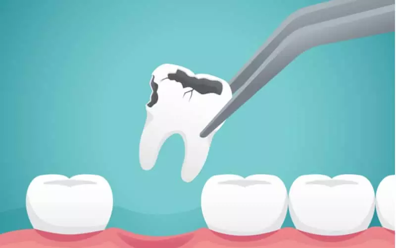  Exploring the Role of Sound Therapy in Enhancing Dental Experiences